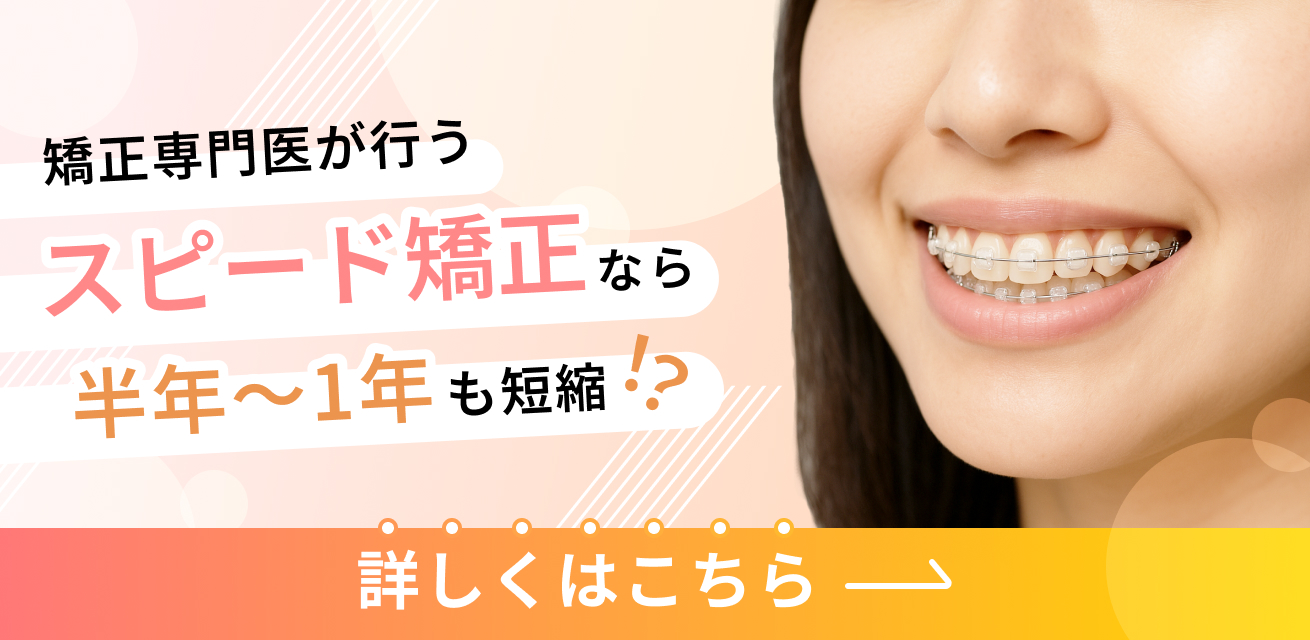 矯正専門医が行うスピード矯正なら半年〜1年も短縮？！ 詳しくはこちら