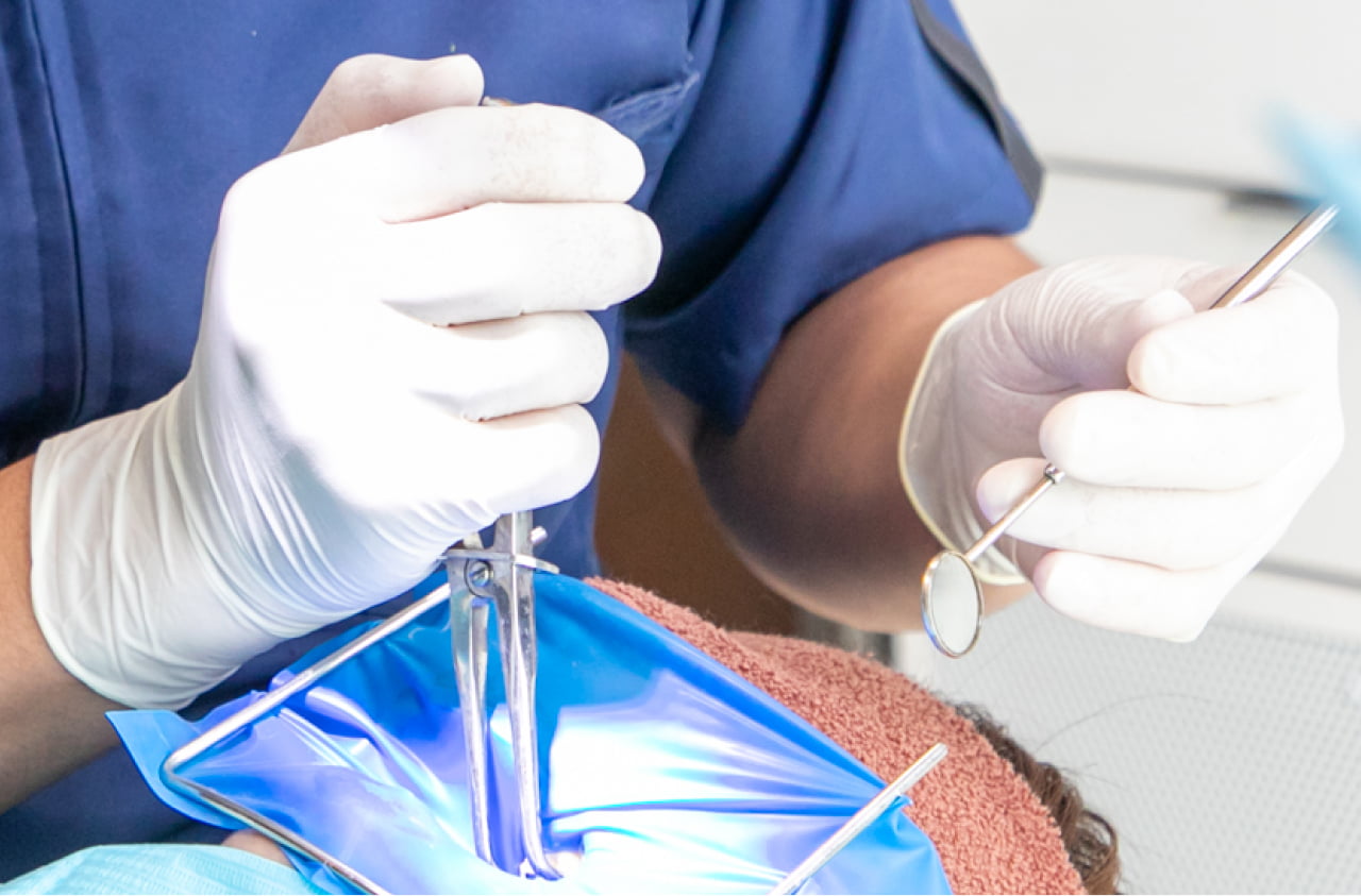 ラバーダム防湿