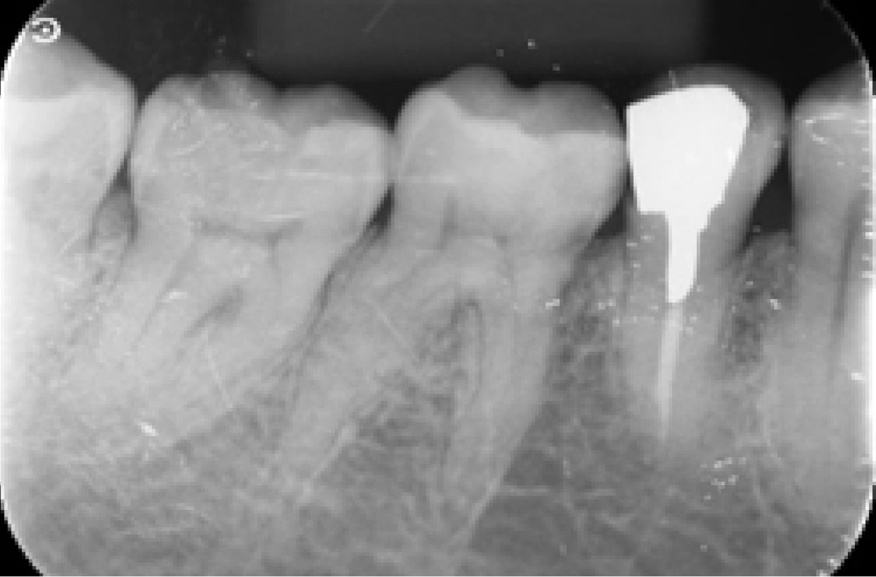 デジタルレントゲン
