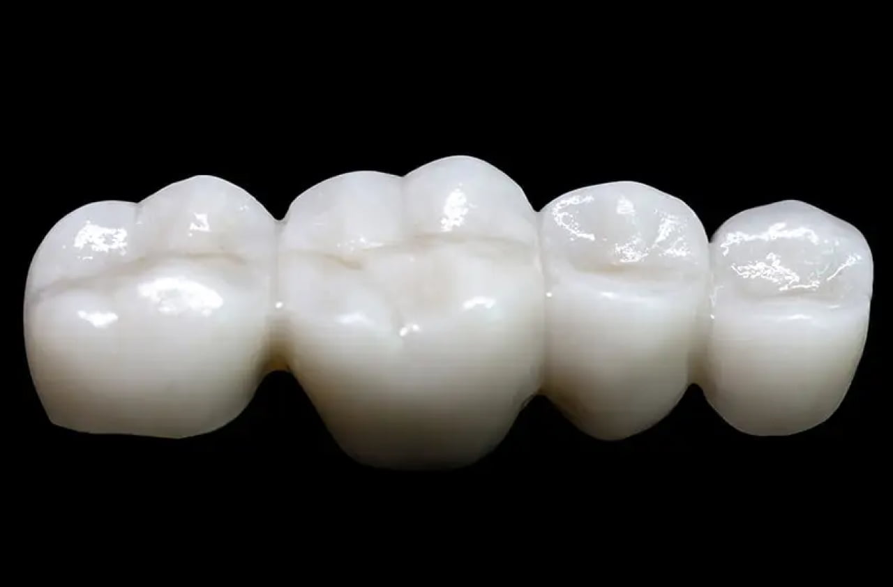 ジルコニアクラン