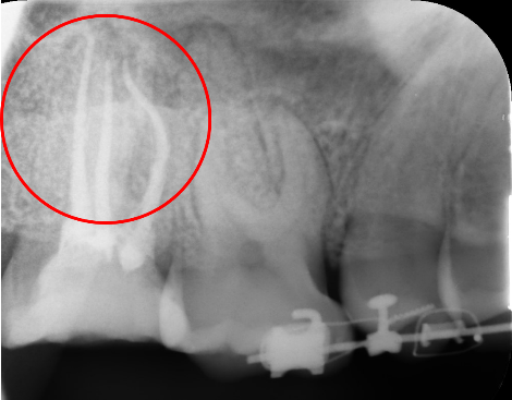 30代 女性の治療画像