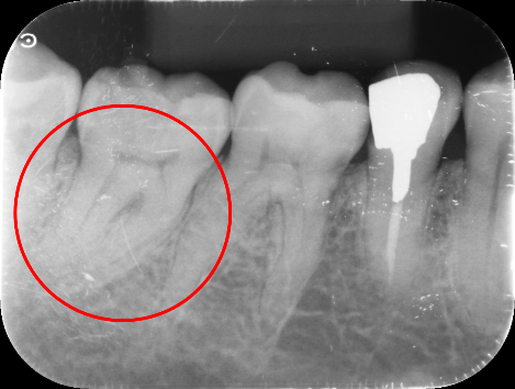 40代 女性の治療画像