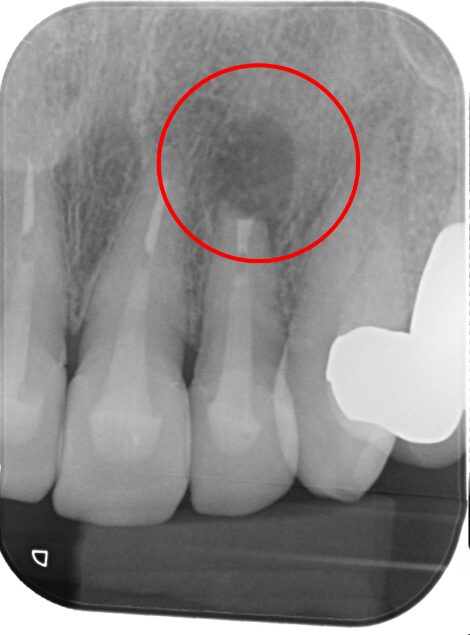 40代 女性の治療画像