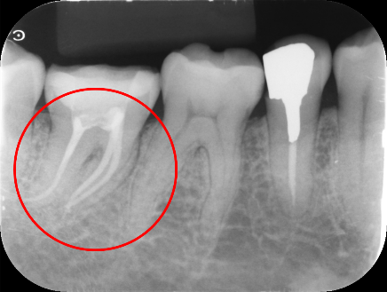 40代 女性の治療画像