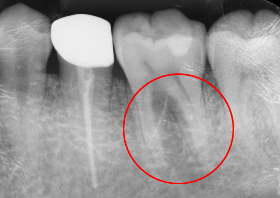 20代 男性の治療画像