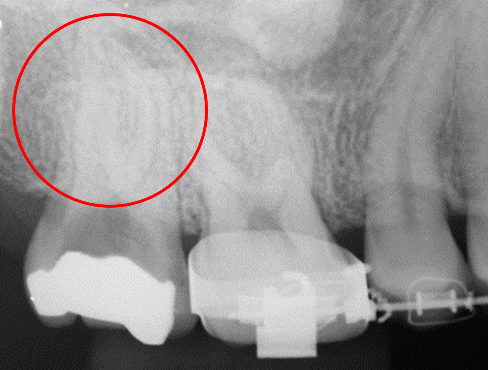 30代 女性の治療画像