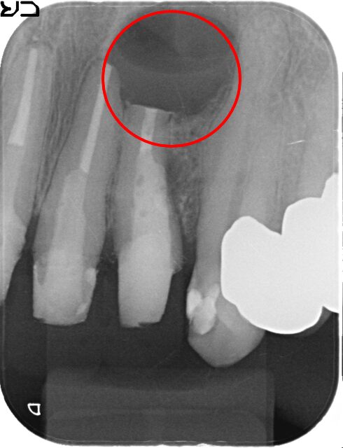 50代 女性の治療画像