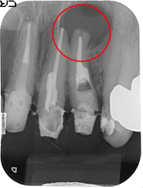 50代 女性の治療画像