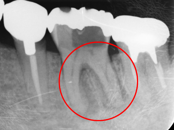 30代 女性の治療画像