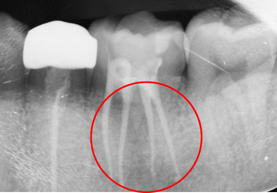 20代 男性の治療画像