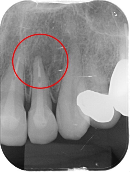 40代 女性の治療画像