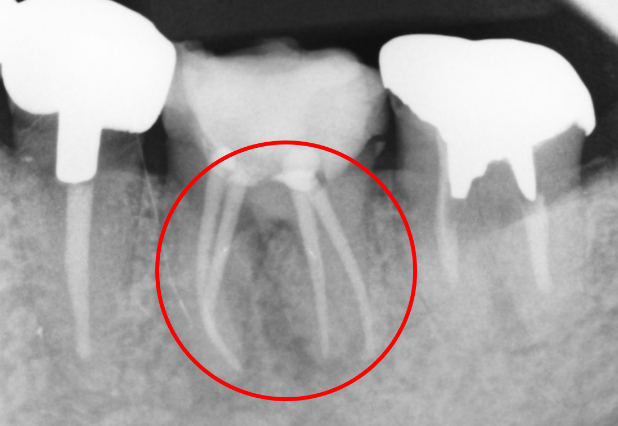 30代 女性の治療画像