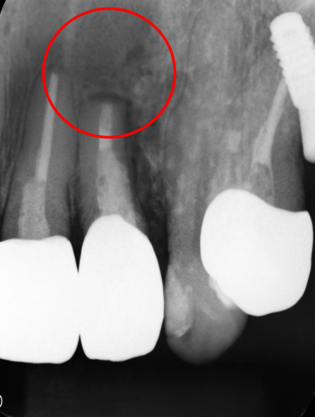 50代 女性の治療画像