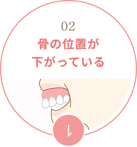骨の位置が下がっている