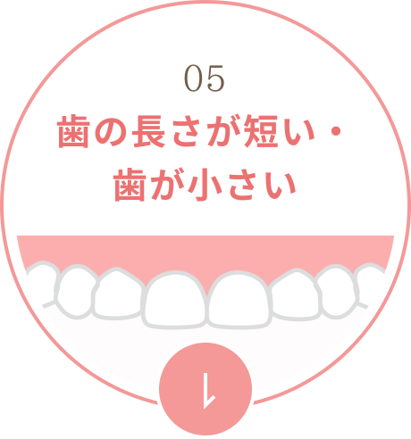 歯の長さが短い・歯が小さい