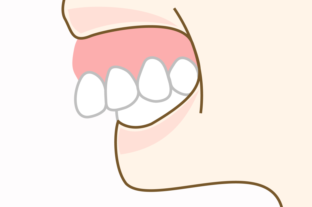 骨の位置が下がっている