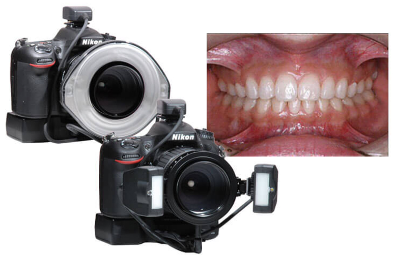 カメラと口腔内写真