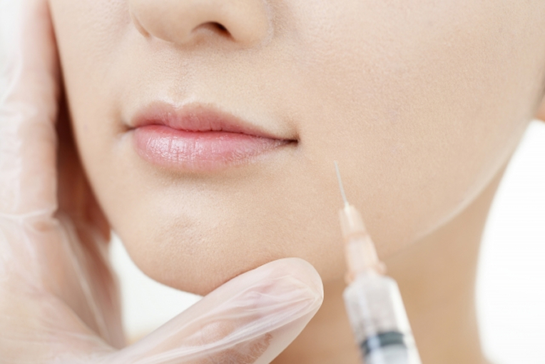 ボトックス注射