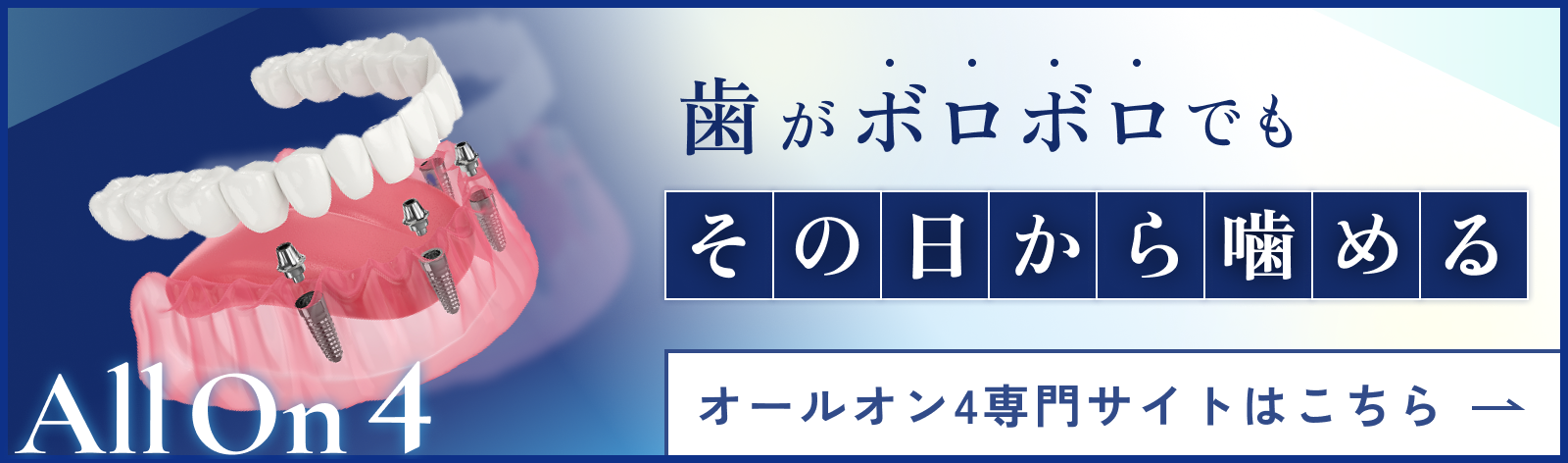 歯がボロボロでもその日から噛めるオールオン4 オールオン4専門サイトはこちら
