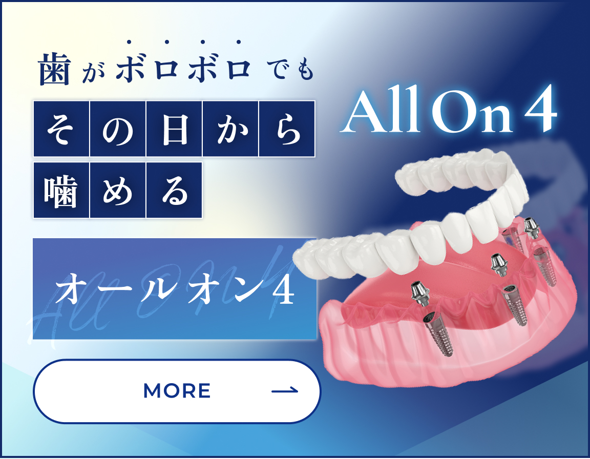 歯がボロボロでもその日から噛めるオールオン4 more